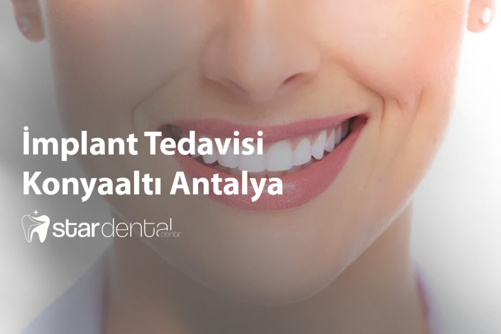 İmplant Tedavisi Konyaaltı Antalya