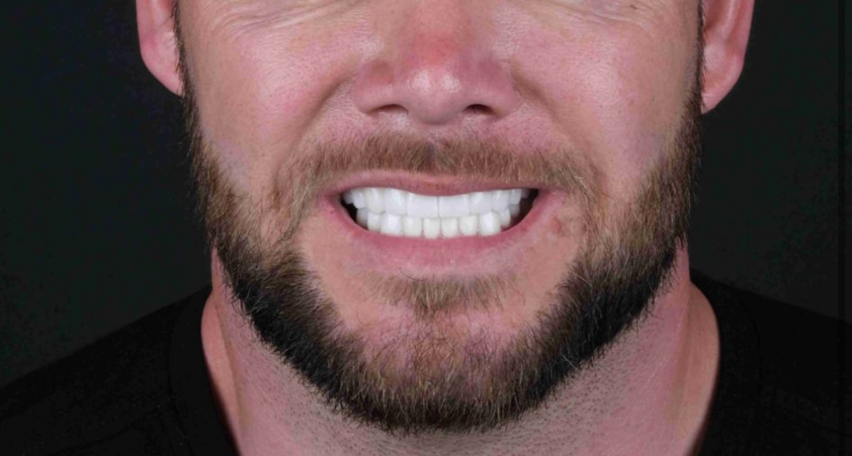 Asım Dental Centre After