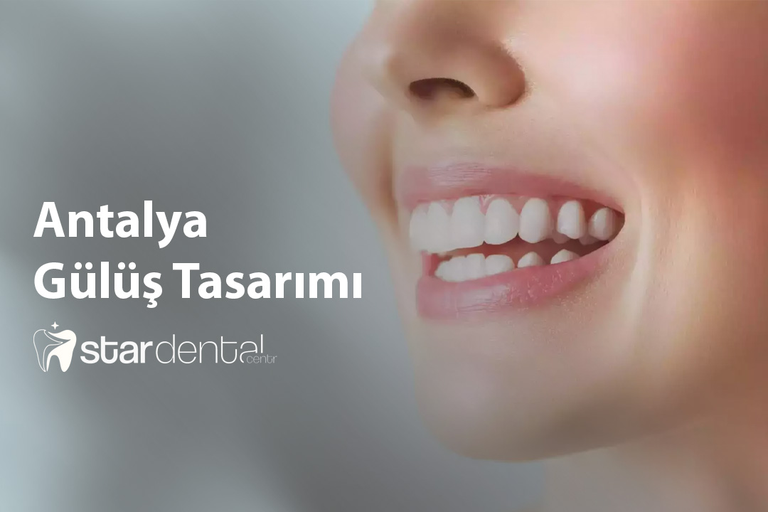 Antalya Gülüş Tasarımı